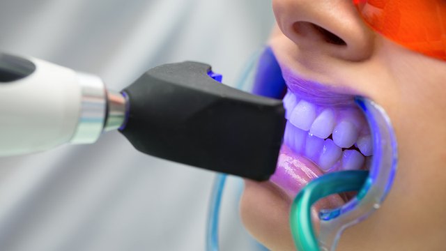 RV Dentistree in Nallagandla